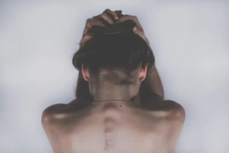 코코넛오일 피부 발진 가려움증 소화 불량 완화 음식 조합